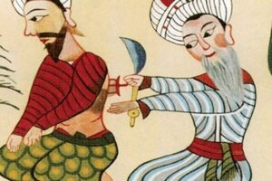 sertleşme sorunu