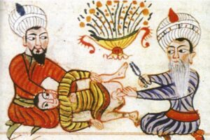 sertleşme sorunu